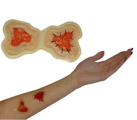 Lot de 2 stickers cicatrices